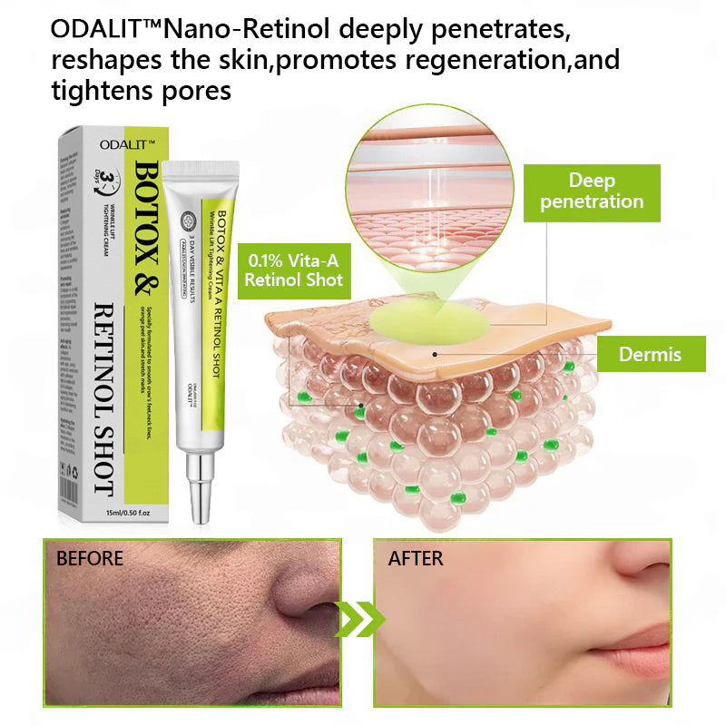 [🔥Posledný deň so 70% zľavou] ODALIT™ Botox a retinolový injekcia - redukuje hlboké vrásky, ochabnuté líce a opuchnuté oči